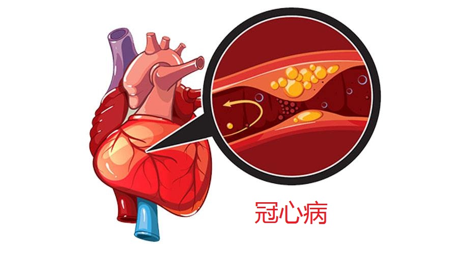肾阳虚