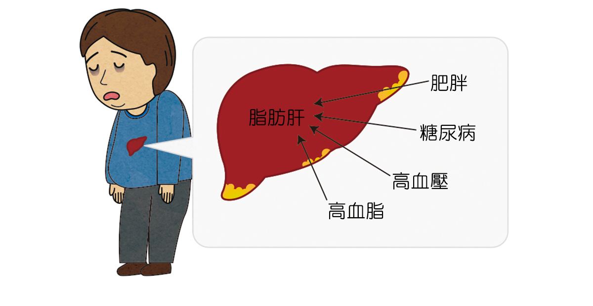 二、脂肪肝的危害