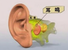 湖北省中医院张林茂：耳鸣的治疗方法有哪些？