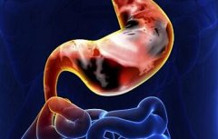 张林茂：慢性胃炎老是胃痛胃胀中医怎么治疗？