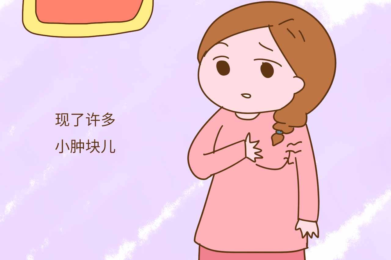 乳腺纤维瘤