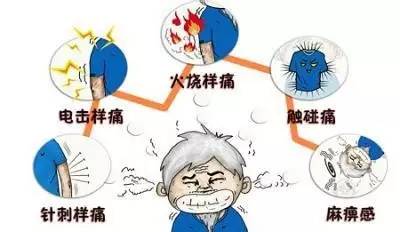 三叉神经痛面部针刺样疼痛中医怎么治疗效果好？