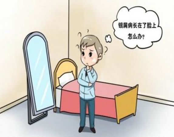 银屑病头颈部红斑瘙痒脱屑中医怎么治疗？