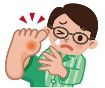 武汉风湿免疫科有名的专家向贤德：痛风关节肿痛尿酸值744中医怎么降下来