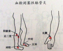 武汉血管外科专家吴隆贵：下肢脉管炎手脚发凉酸痛无力夜晚加重吃什么中