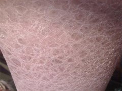 皮肤粗糙干燥脱屑，出现白色鱼鳞纹路是什么病？