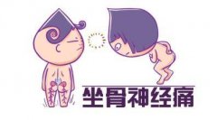 臀部、大腿后侧发生烧灼样或针刺样疼痛中医针药并用治疗坐骨神经痛效果
