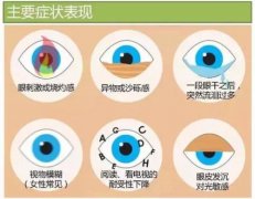 干眼症双眼干涩视物模糊中医怎么治疗效果好？名老中医柳新樵针药并用症