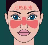 名老中医范平专攻疑难杂症和皮肤病40余年：中医治疗红斑狼疮的优点？