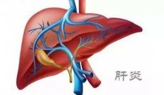 武汉名老中医徐长化教授：慢性乙型病毒性肝炎两胁胀痛疲乏口干心烦吃什