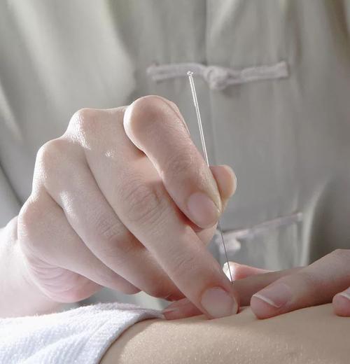 腰痛5年余,平时坐立难安平躺困难,武汉疼痛骨科名中医柳新樵针药并用