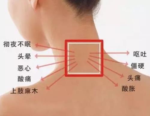 j颈椎病的症状