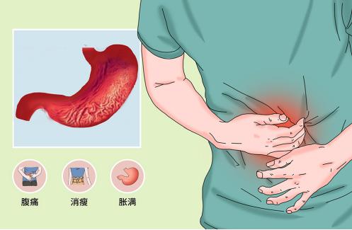 中医治疗浅表性胃炎