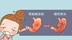 武汉诚顺和中医肠胃病专家张压西：长期慢性胃炎腹痛反酸吃什么中药？
