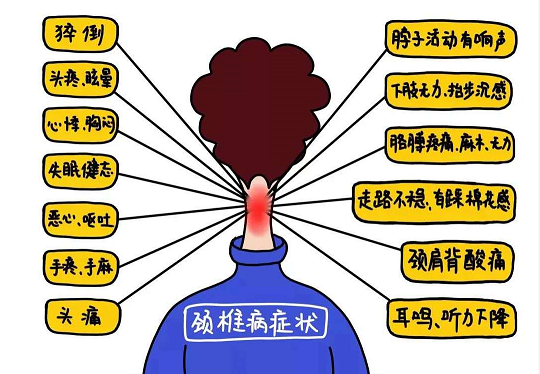 颈椎病有哪些症状？