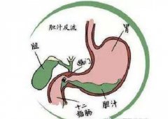 武汉调理脾胃特别厉害的中医王垚：胆汁返流性食管炎泛酸胃烧灼反复发作