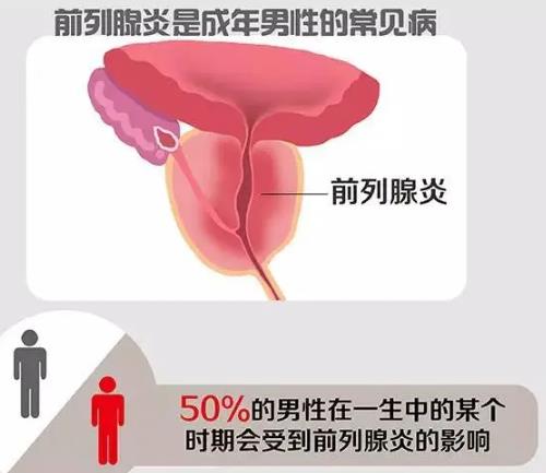 慢性前列腺炎医案