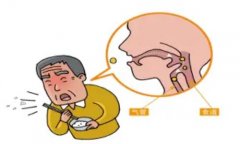 武汉针药并用调理身体的中医王垚：食道癌术后吞咽困难饭后胃胀泛酸怎么