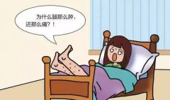 武汉疼痛骨科专家熊勇博士：腿肿痛是什么原因引起的中医治疗有哪些方法