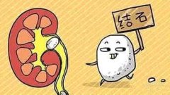 湖北咸宁内科专家李轩锦教授：肾结石腰部绞痛疼痛难耐中医能根治吗?