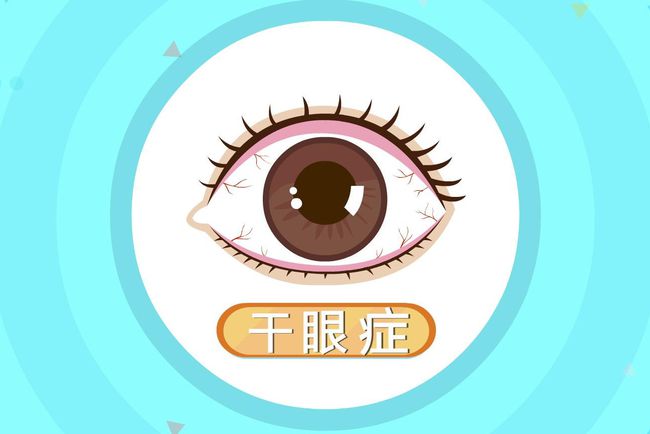 干眼症有哪些症状？