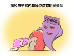 中医学博士妇科专家姜瑞雪：痛经11年子宫内膜异位症中医治疗调理好转医