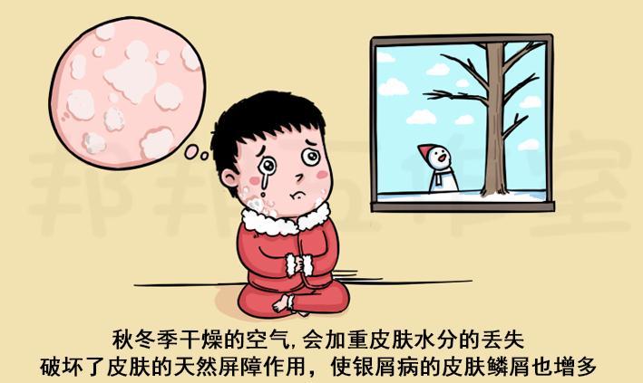 儿童银屑病中医治疗医案
