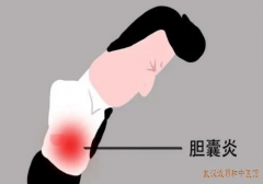 肝胆疾病专家张压西教授：急性胆囊炎右胁部疼痛恶心呕吐喝中药好的快吗