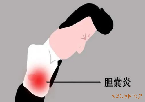 急性胆囊炎中医治疗医案