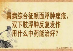 武汉中医李家发教授：肾病综合征颜面浮肿痤疮、双下肢浮肿反复发作用什