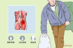 疼痛专科门诊柳新樵主任：长期过劳腰椎骨质疏松痠痛中医能不能治疗?