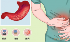 荆州知名肠胃病调理专家张压西：胃部胀满嗳气不舒中医怎么治疗胃痞病？