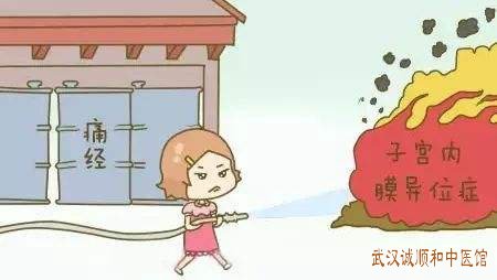 擅治妇科病的中医博士姜瑞雪：痛经9年查有子宫内膜异位症卵巢巧克力囊肿中医怎么调治?