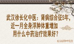 武汉徐长化中医：肾病综合征5年，近一月全身浮肿体重增加用什么中药治疗