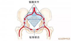 武汉最厉害老中医柳新樵治关节疼痛：骶髂关节退变有增生及骨刺中医调理