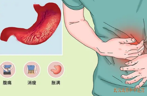 萎缩性胃炎中医张林茂治疗医案一则