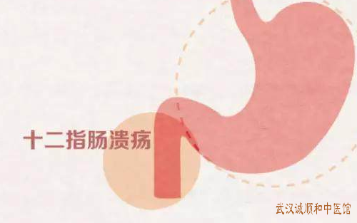 十二指肠溃疡中医肠胃病专家张压西治疗医案一则