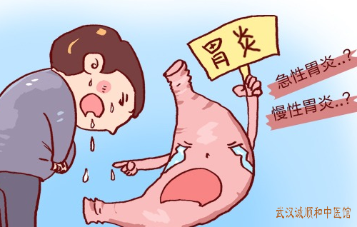 慢性胃炎胃痛胃胀有烧灼感中医中药治疗医案一则