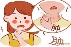 武汉疑难杂症专家名老中医李轩锦：甲亢脖子粗压力大脾气急躁吃中药有用
