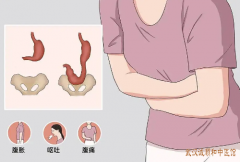 张林茂医生坐诊时间：胃下垂食后腹胀腹痛有下坠感反复不愈中医治疗医案