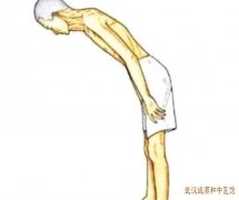 武汉诚顺和中医风湿专家宋跃进：强直性脊柱炎腰骶部疼痛活动不利怎么调