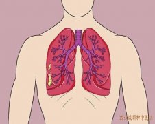 武汉治疗肺部结节老中医专家钟明：肺结节胸闷气短易累中医怎么治疗好