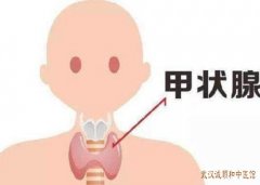 武汉名老中医治疗甲状腺结节钟明教授：甲状腺结节3类咽喉不适中医怎么调