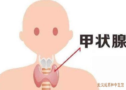 武汉名老中医治疗甲状腺结节钟明教授甲状腺结节医案一则