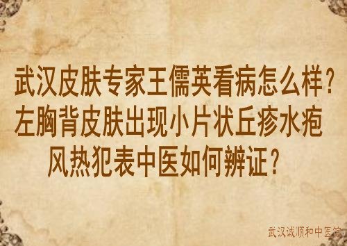 皮肤专家王儒英看病怎么样?左胸背皮肤出现小片状丘疹水疱风热犯表中医如何辨证?