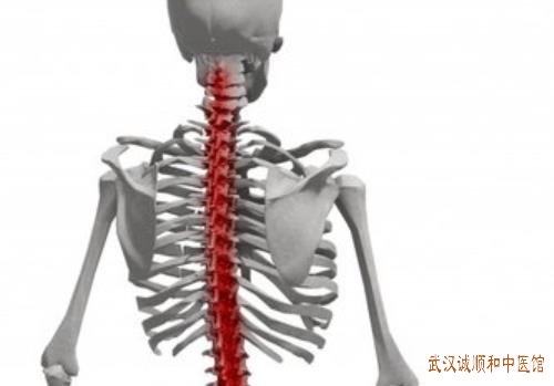 武汉擅治颈肩腰腿痛的老中医柳新樵：间断性头晕颈肩痛手臂麻木耳鸣中医怎么治疗?