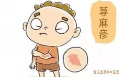 皮肤科胡爱玲：慢性荨麻疹全身泛发风团伴瘙痒5年余饮食不慎即发作怎么治