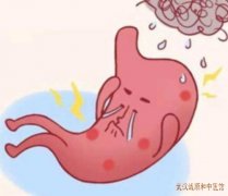湖北省武汉肠胃病中医吴永贵：胆汁反流性胃炎反酸烧心吃什么中药调理？