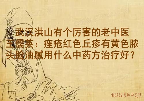 武汉洪山有个厉害的老中医王儒英：痤疮红色丘疹有黄色脓头脸油腻用什么中药方治疗好？
