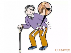 武汉骨伤科名中医董晓俊：左髋部疼痛明显行走尤甚头重乏力中医如何治疗